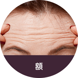 額