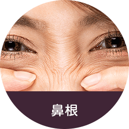 鼻根