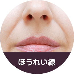 ほうれい線