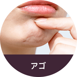 アゴ