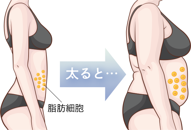 脂肪細胞が膨らむイメージ
