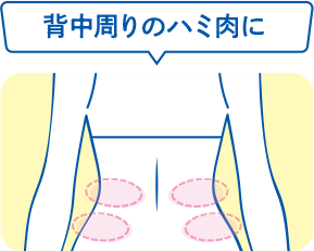 背中周りのハミ肉に対応する4部位パターン