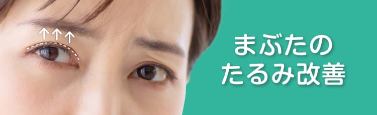 まぶたのたるみ改善