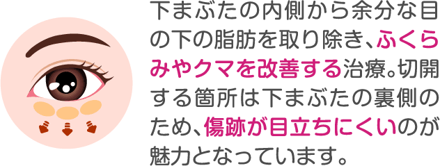下まぶたの内側から余分な目の下の脂肪を取り除き、ふくらみやクマを改善する治療。切開する箇所は下まぶたの裏側のため、傷跡が目立ちにくいのが魅力となっています。